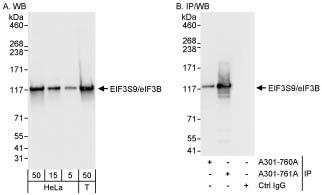 Detection of Human EIF3S9/eIF3B by Western Blot and Immunoprecipitation. 