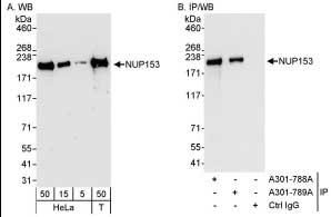 Detection of Human NUP153 by Western Blot and Immunoprecipitation