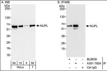 Detection of Human NUPL by Western Blot and Immunoprecipitation