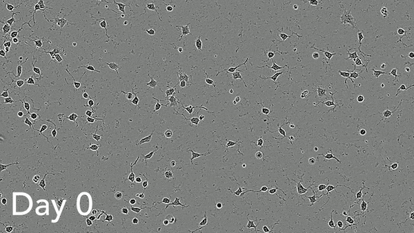 ioMotor Neurons�̕����E���n�̗l�q���B�e��������