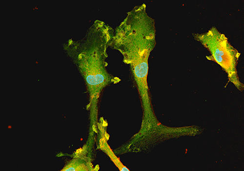 ioGlutamatergic_neuron