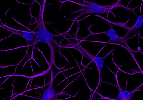 ioGlutamatergic_neuron