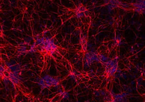 ioGlutamatergic_neuron