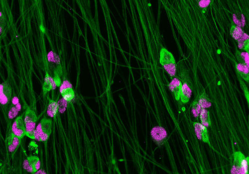 ioSensory_neuron