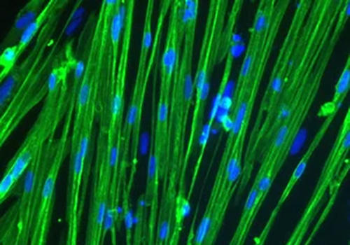 ioGlutamatergic_neuron
