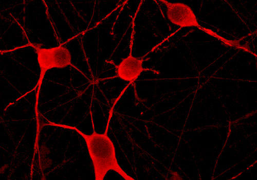 ioMoter_neuron