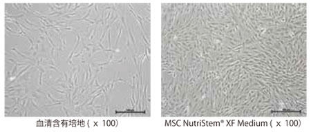 脂肪由来ヒトMSC の3 日間培養後の形態写真（播種時 の細胞密度：6,000 cells/cm2）。