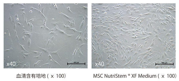 骨髄由来ヒトMSC の3 日間培養後の形態写真（播種時 の細胞密度：5,000 cells/cm2）。