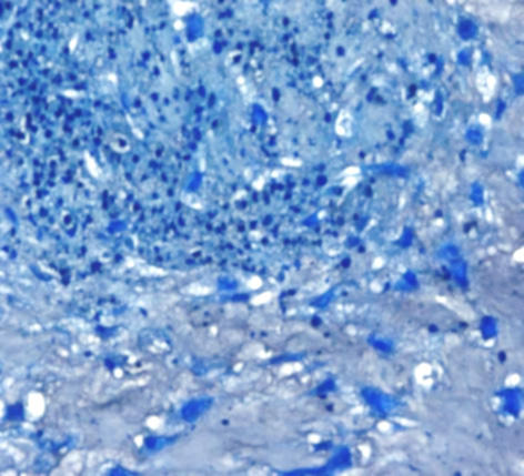 ヒト間葉系幹細胞（hMSC-BM）から脂肪分化