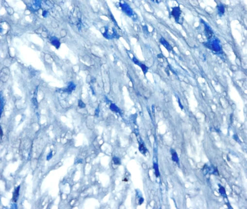 ヒト間葉系幹細胞（hMSC-CT）から脂肪分化