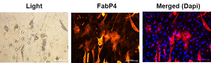 hMSC b11FABP4̔