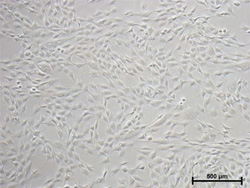 間葉系幹細胞の凍結保存