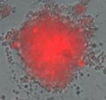 U2OS スフェロイドの染色