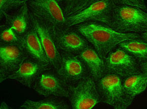 固定化 U2OS 細胞の対比染色