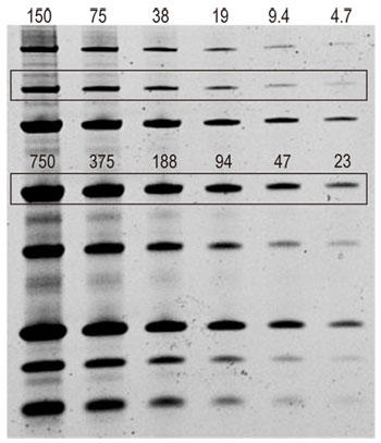 One-Step Lumitein UV で染色した SDS-PAGE ゲル
