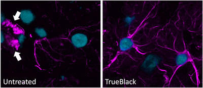 TrueBlack(TM) ^̖ƉuuF摜