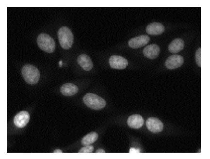 RedDot1によるHeLa細胞の染色