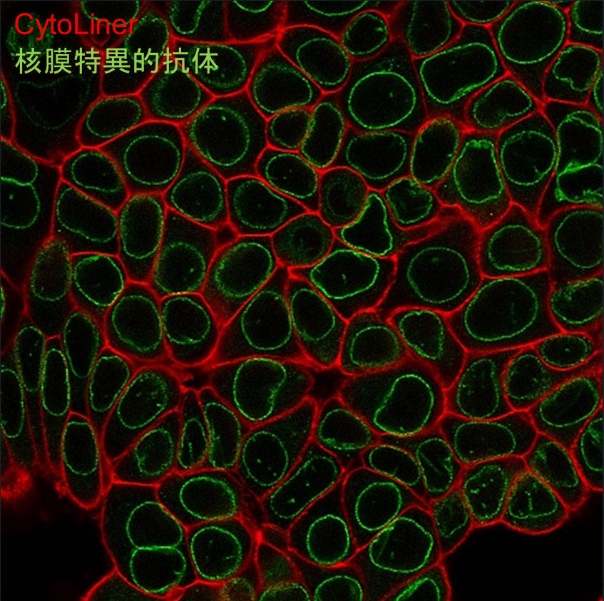 BTI_cell_membrane_surface_01.jpg