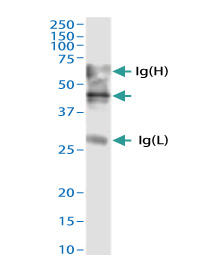 ADAMTS4認識ウサギポリクローナル抗体 - 免疫沈降の適用例