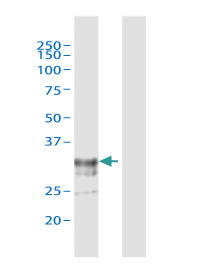 ADAMTS4認識ウサギポリクローナル抗体 - ウェスタンブロットの適用例