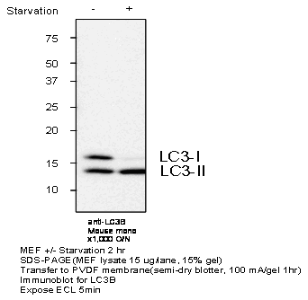 LC3omN[iR̂gpEFX^ubg