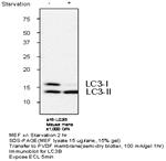 RLC3omN[iR