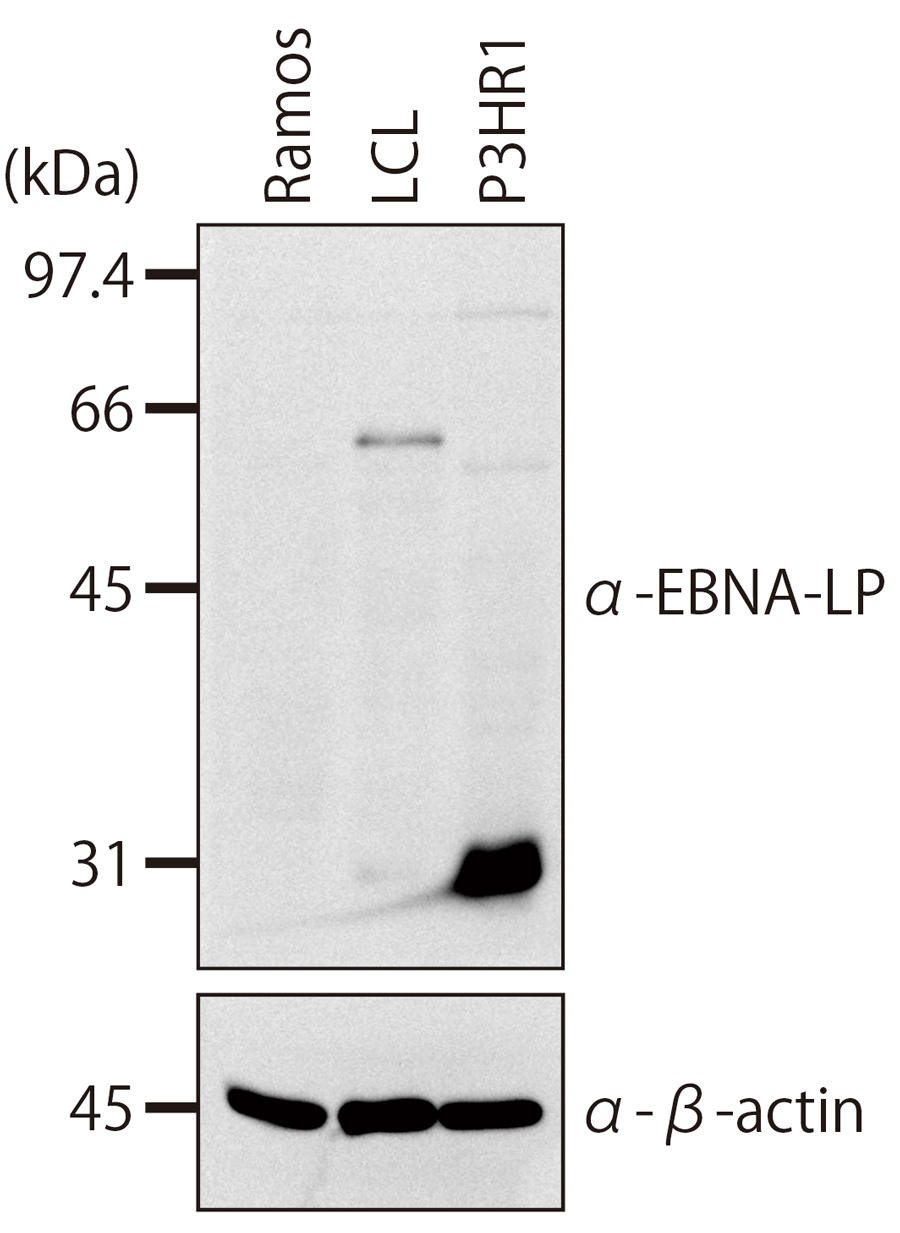 EBNA-LPR̂pEGX^ubg