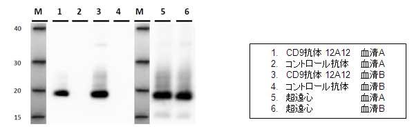 IP-WB of serum exosome by CD9 antibody 12A12