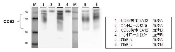 CD63抗体8A12による血清中ExosomeのIP-WB