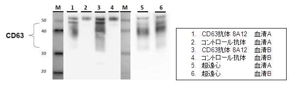 IP-WB of serum exosome by CD63 antibody 8A12