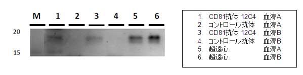 CD81抗体12C4による血清中ExosomeのIP-WB