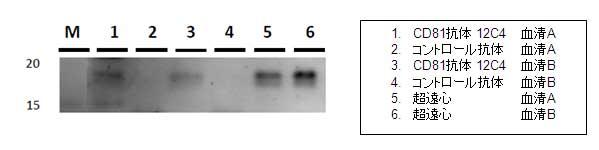 IP-WB of serum exosome by CD81 antibody 12C4