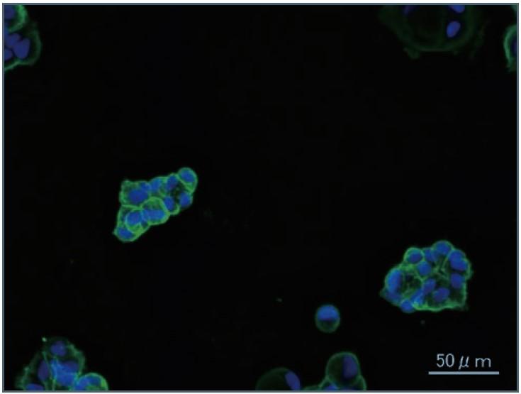 ZR-75-1 細胞株の免疫染色画像