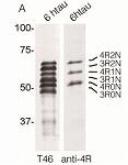4R-tau 抗体:主に認知症、タウオパチーの研究に