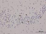 TDP-43 のリン酸化抗体:主に筋萎縮性側索硬化症(ALS)、前頭側頭葉変性症(FTLD)研究に