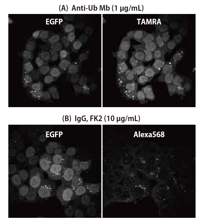 CAC_panubiquitin_IHC_01.png