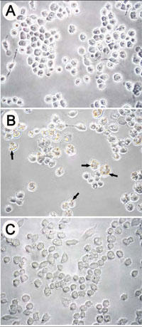 Cytochalasin D によるマクロファージ（Raw264.7）細胞のファゴサイトーシス阻害