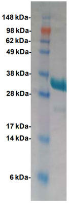 Cas13a Rrig^pN̐