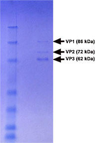 AAV2-GFP̓dCj