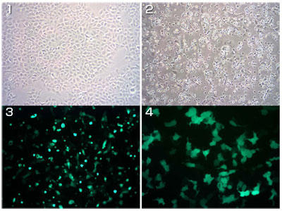 AAV2-GFP