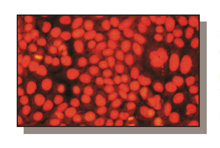 microRNA Analysis
