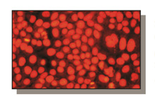 microRNA Analysis