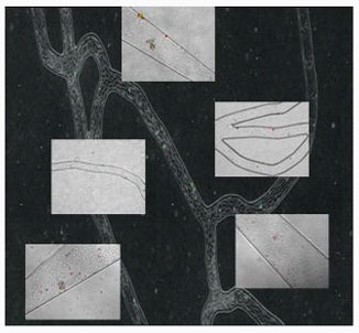 Particle Interaction on Inflammed Endothelium