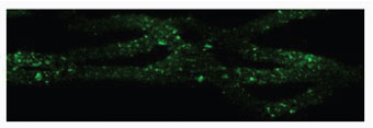 Nanopolymer Delivery for Gene Therapy