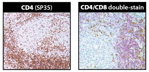 CD4ETMmN[iR̂gpƉugDF