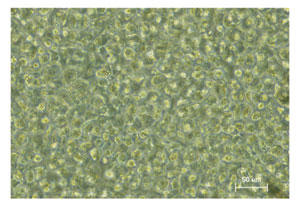 Figure 5 Phase-contrast micrograph of rabbit chondrocytes