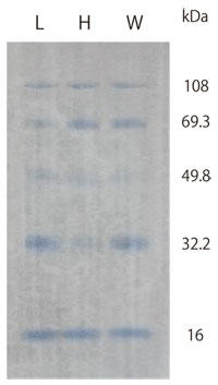 SDS-PAGE Ɋe}[J[ PVDF ɓ]