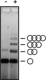 Single-stranded DNA catenation mediated by human EVL and a type I topoisomerase