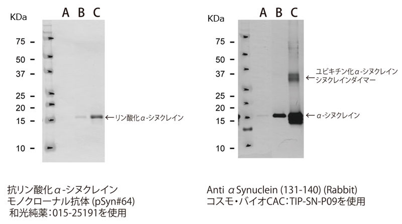 CSR_alpha_synuclein_1.jpg