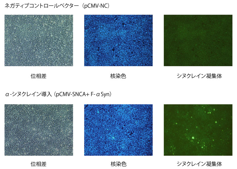 CSR_alpha_synuclein_2.jpg